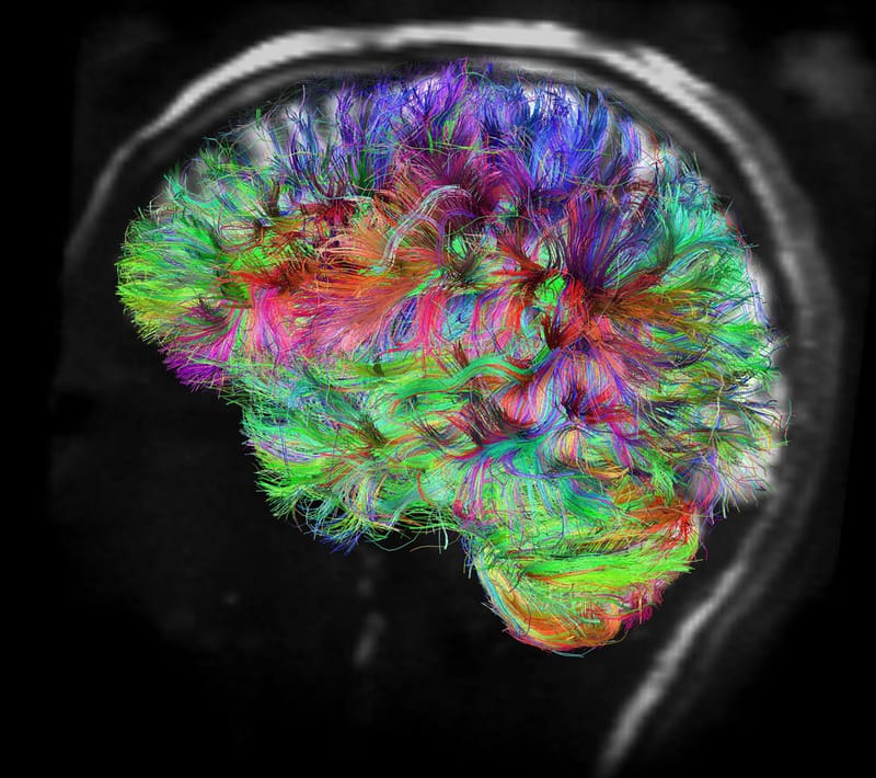 human brain scan